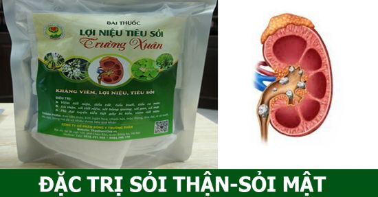 Lợi Niệu Tiêu Sỏi - Đặc trị sỏi thận, sỏi tiết niệu Lợi Niệu Tiêu Sỏi - Đặc trị sỏi thận, sỏi tiết niệu