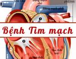 Điều trị bệnh tim như thế nào là hiệu quả?